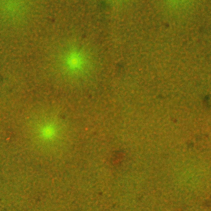 На этом видео с большим увеличением нитевидные микротрубочки (зелёные) располагаются в цитоплазме так, чтобы лучами отходить от содержащихся в ней ядер (синих) или от других центров. Эндоплазматические сети (красные) также располагаются рядом с ядрами.