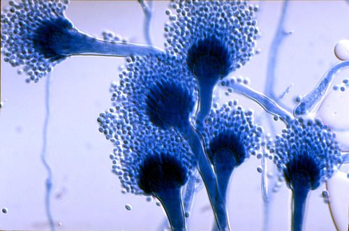 Грибок Aspergillus fumigatus, возбудитель аспергиллёзов.