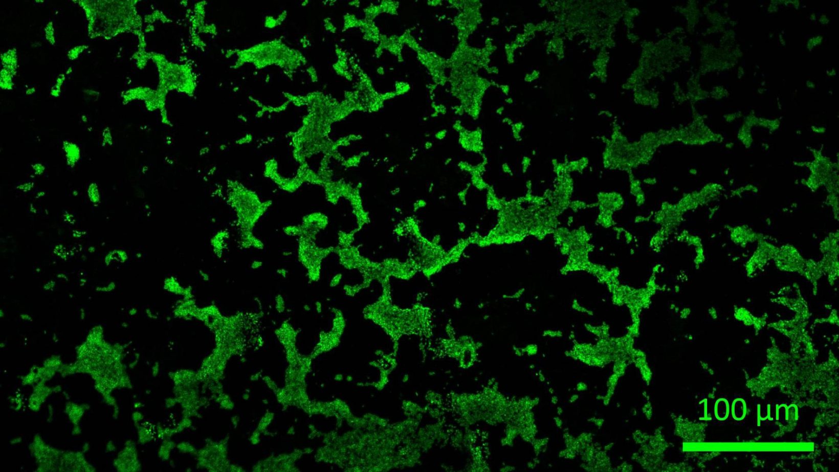 Bacillus subtilis biofilm